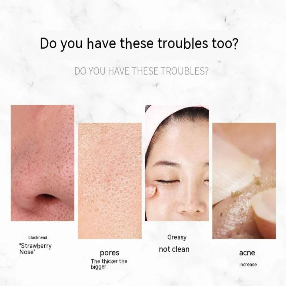 Ultrasonic Skin Care Scraper Blackhead Remover