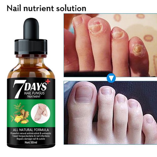 Serum zur Behandlung von Nagelpilz