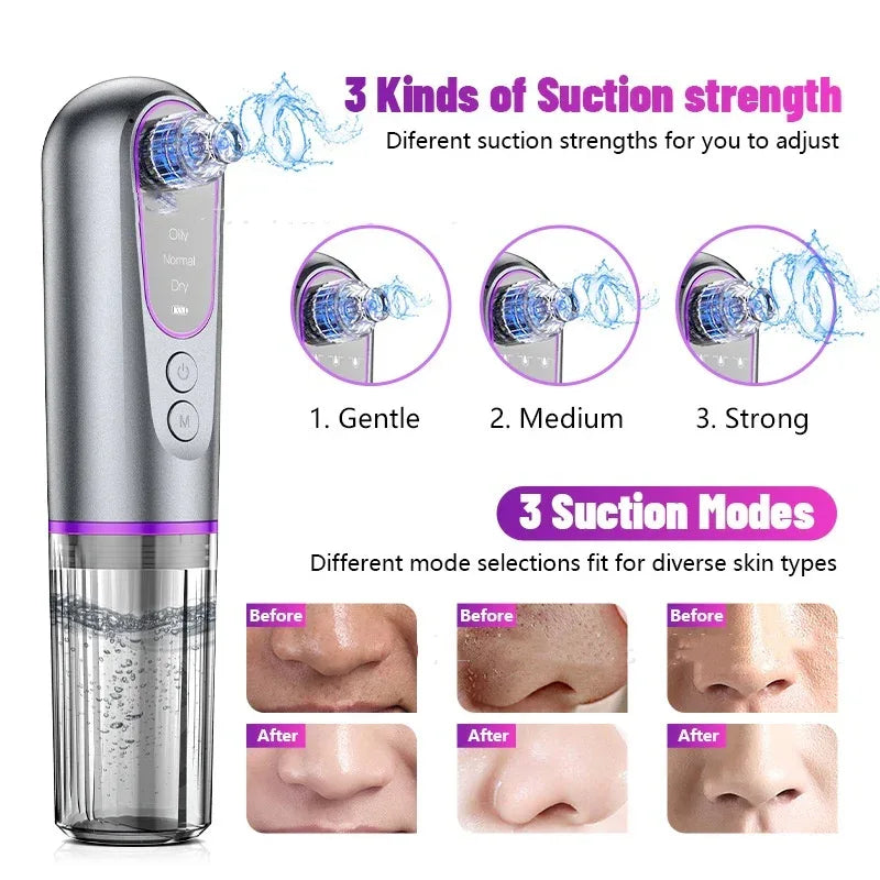 Facial Blackhead Removal Device With Water Tank Pore Cleaner