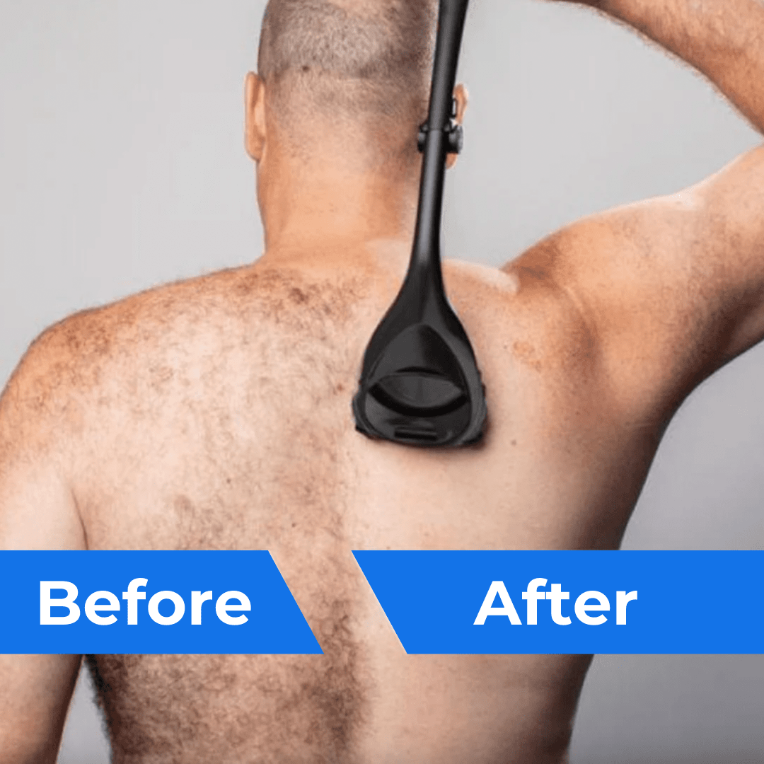Ryggtrimmer för män – Enkel och smidig borttagning av rygghår hemma